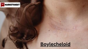 Boylecheloid