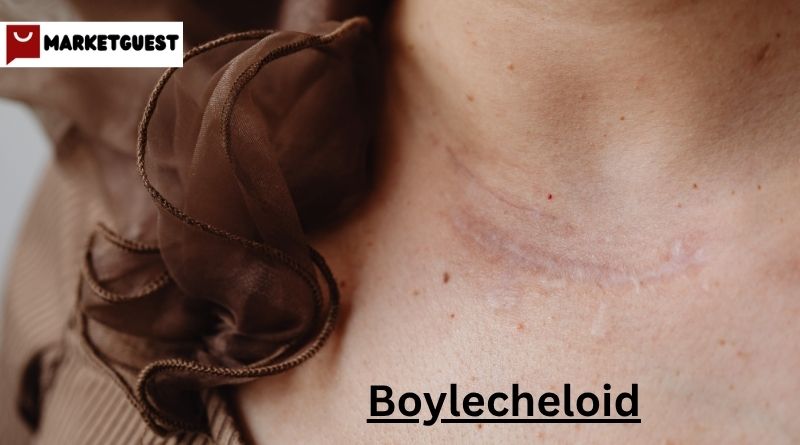 Boylecheloid